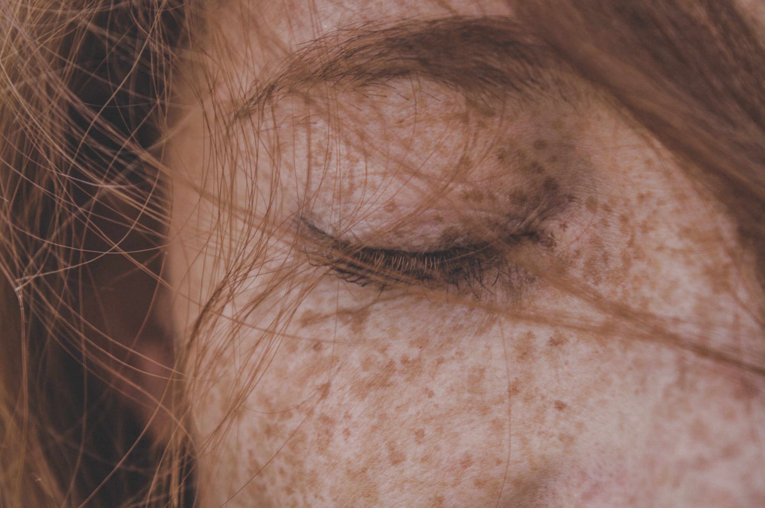 Why Can’t I Fully Close My Eye? associated image