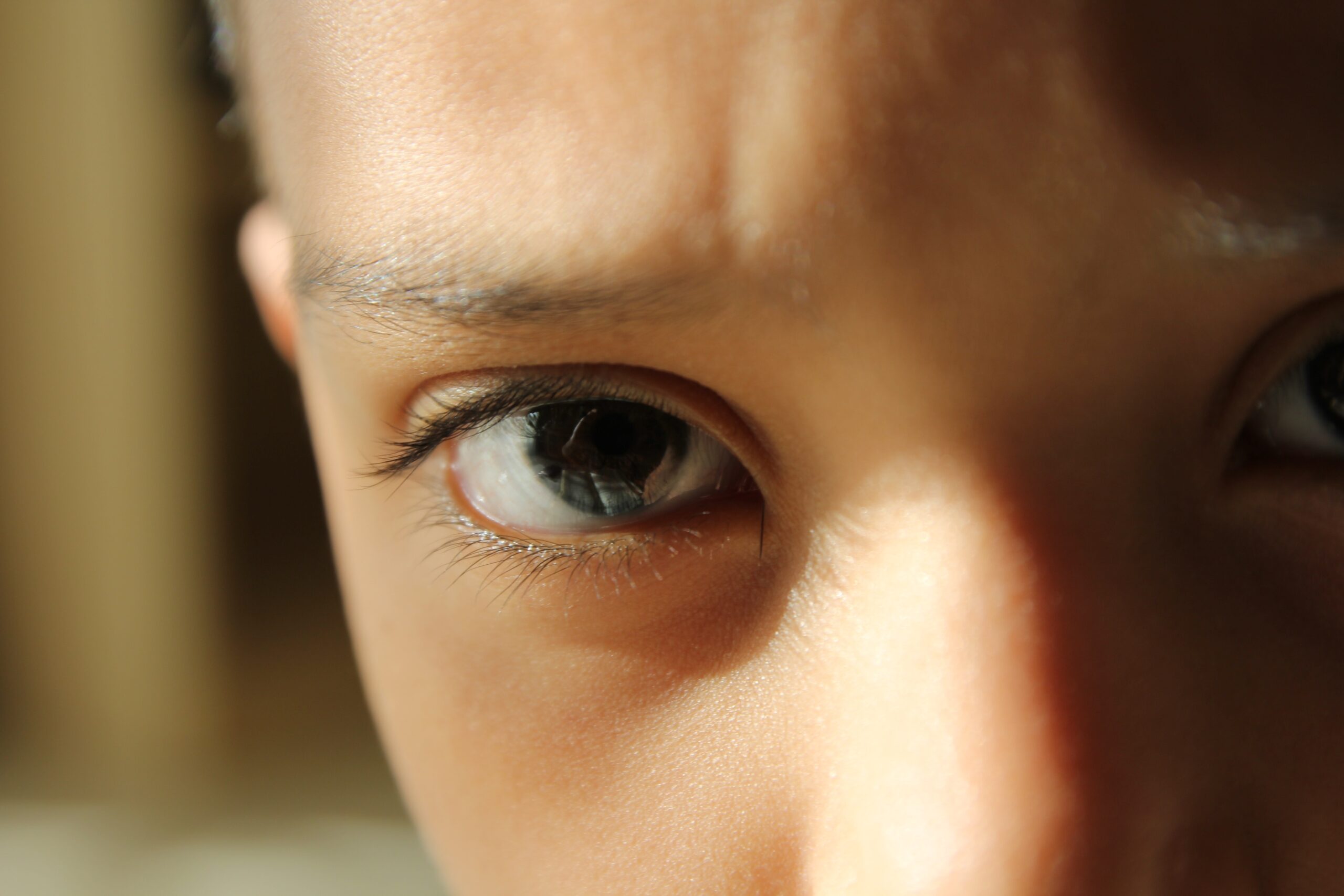 What Might Cause Temporary Vision Loss in Children? associated image