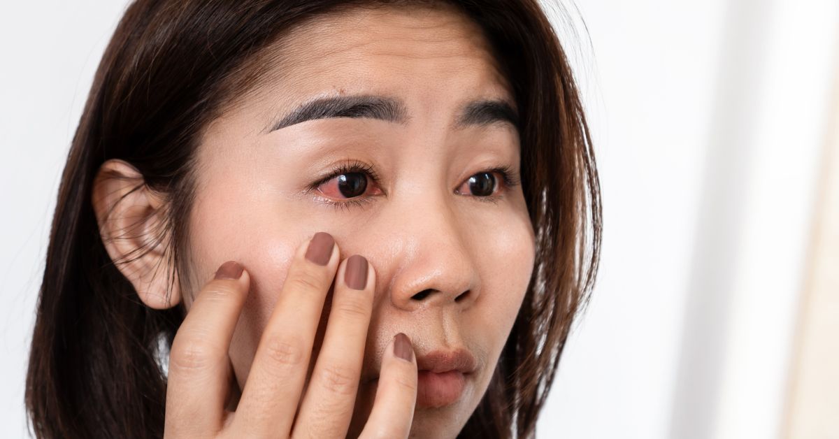 Red, Itchy, or Dry? Breaking Down Common Causes of Eye Irritation associated image